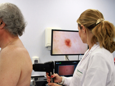 El Hospital Vithas Nisa Sevilla se suma a la celebración de la Semana del Euromelanoma